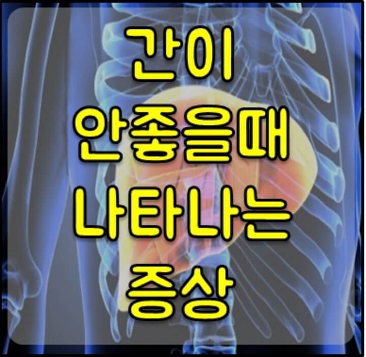 간이 안좋을때 나타나는 증상 썸네일