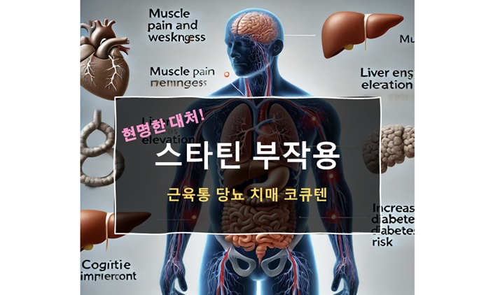 스타틴 부작용