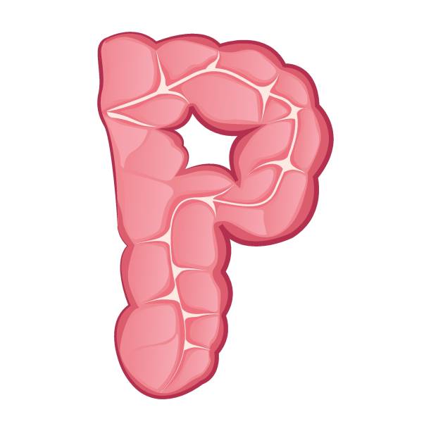 급성 맹장염 초기증상