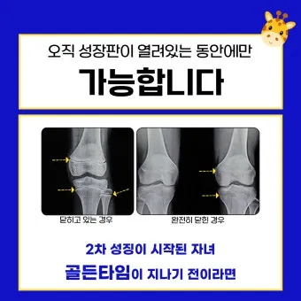 성장판 닫혀도 키 클 수 있는 방법과 성장 호르몬 시기_25