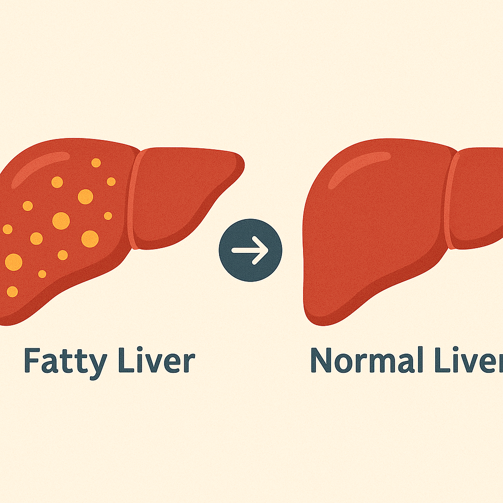 “왼쪽에는 노란 지방이 점점처럼 보이는 지방간, 오른쪽에는 매끈하고 건강한 정상 간이 나란히 배치된 일러스트. 가운데에는 방향을 나타내는 화살표가 있으며, 지방간과 정상 간의 차이를 시각적으로 비교해 보여준다.”