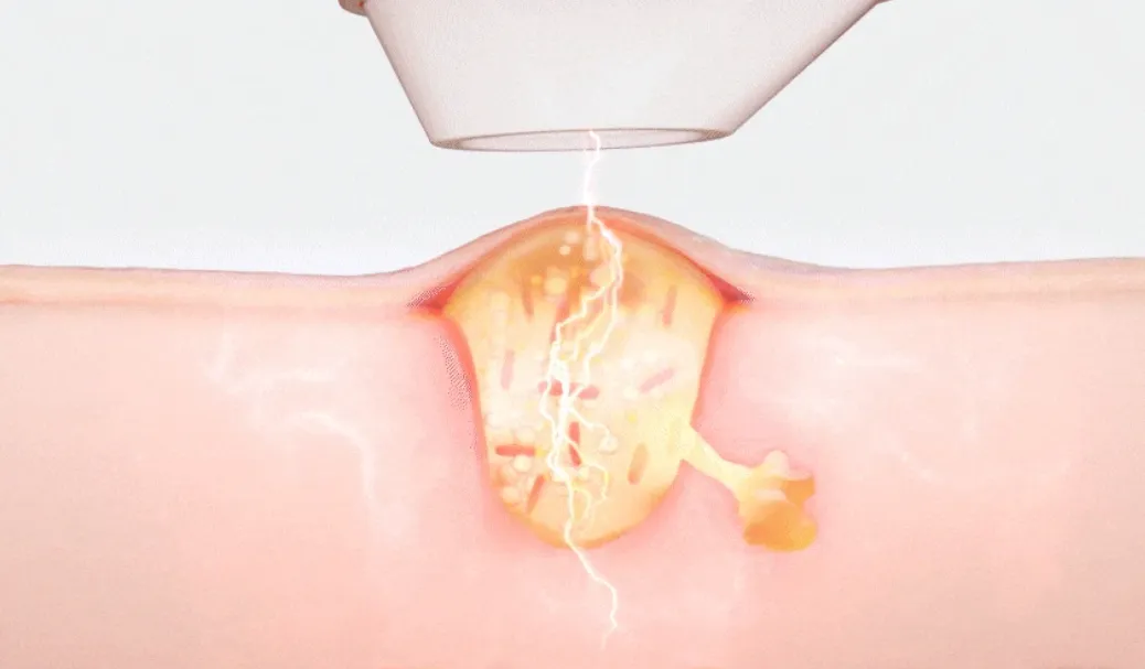 식스킨-볼케이노샷-정식몰-바로가기
