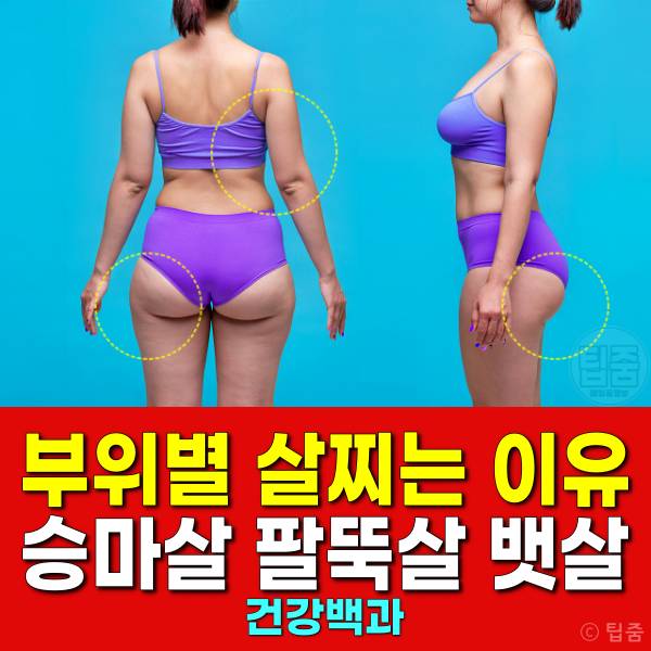 부위별 살찌는 이유 승마살 팔뚝살 뱃살 옆구리살 등살
