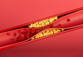 2025 고혈압&middot;당뇨 등 만성질환 관리 프로그램 확대