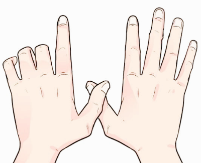 방아쇠 수지 증후군 치료법