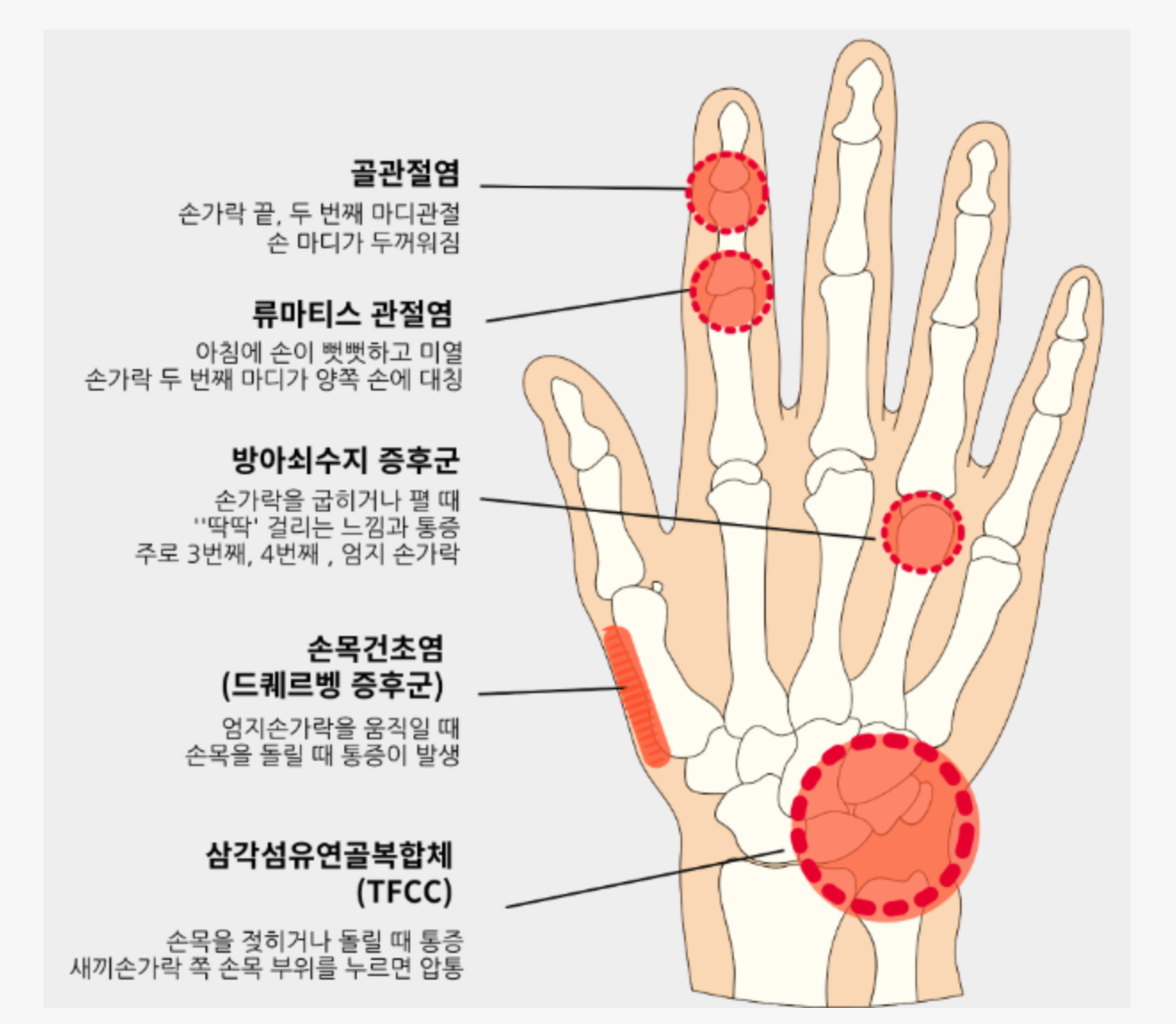 증상 자가 체크리스트