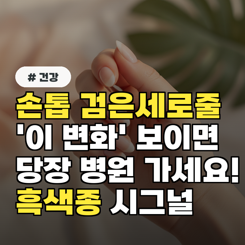 손톱 검은세로줄, '이 변화' 보이면 당장 병원 가세요! 흑색종 시그널