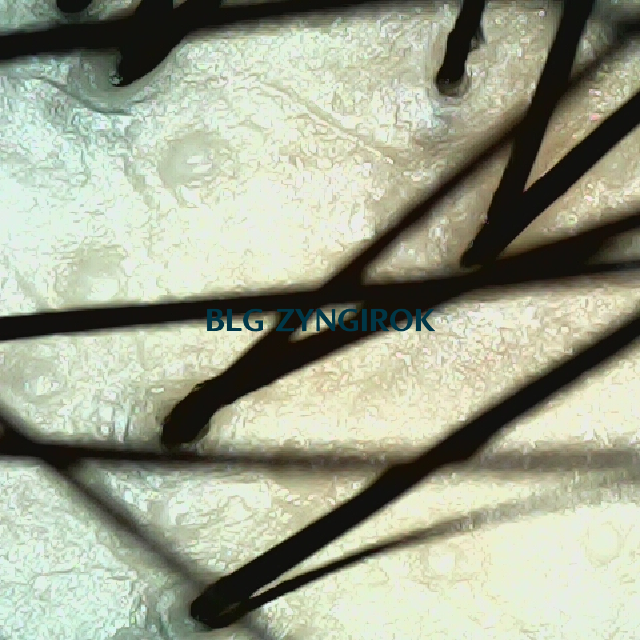 탈모 극복 프로젝트 - 정수리 두피모습이다.