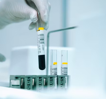 폐경기 검사 방법