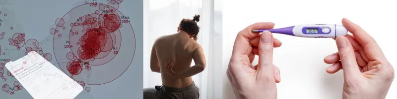 수두 홍역 차이