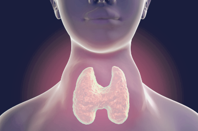 갑상선 기능 저하증 증상이 의심된다면?