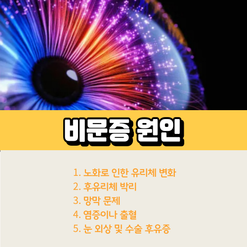 비문증원인