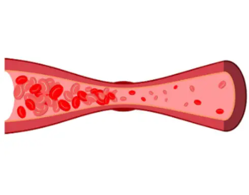 hdl-콜레스테롤-높이는-방법-정상수치-건강