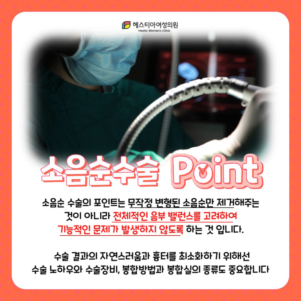 소음순수술 포인트