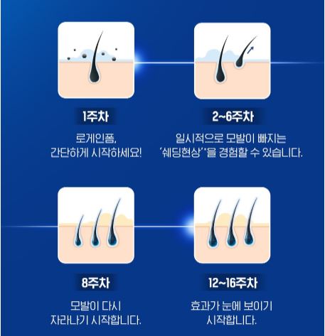 로게인폼 효과