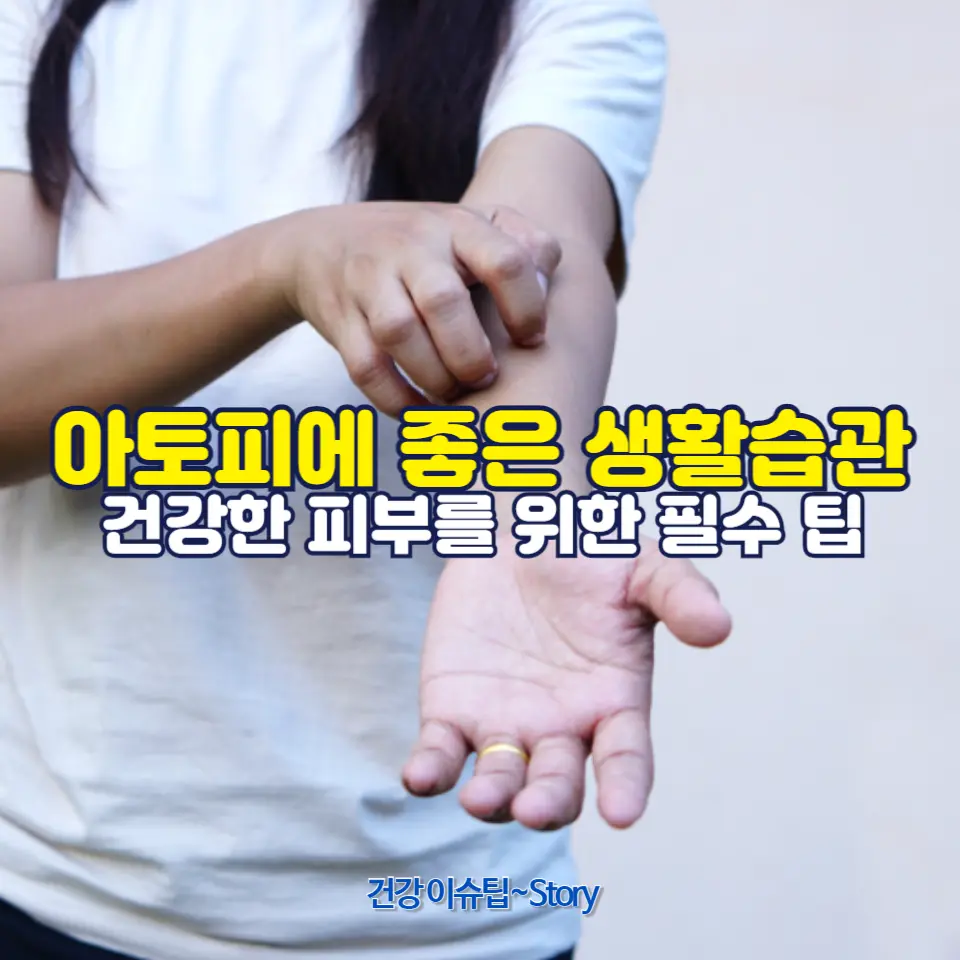 아토피 악화를 예방