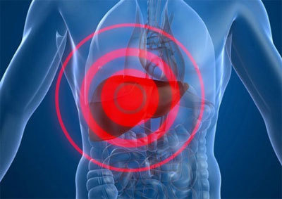 간암 예방에 좋은 음식 10가지
