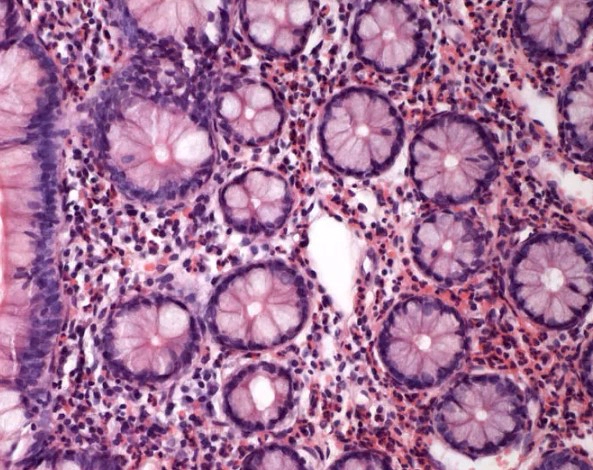 장염 먹어도 되는 음식 12가지