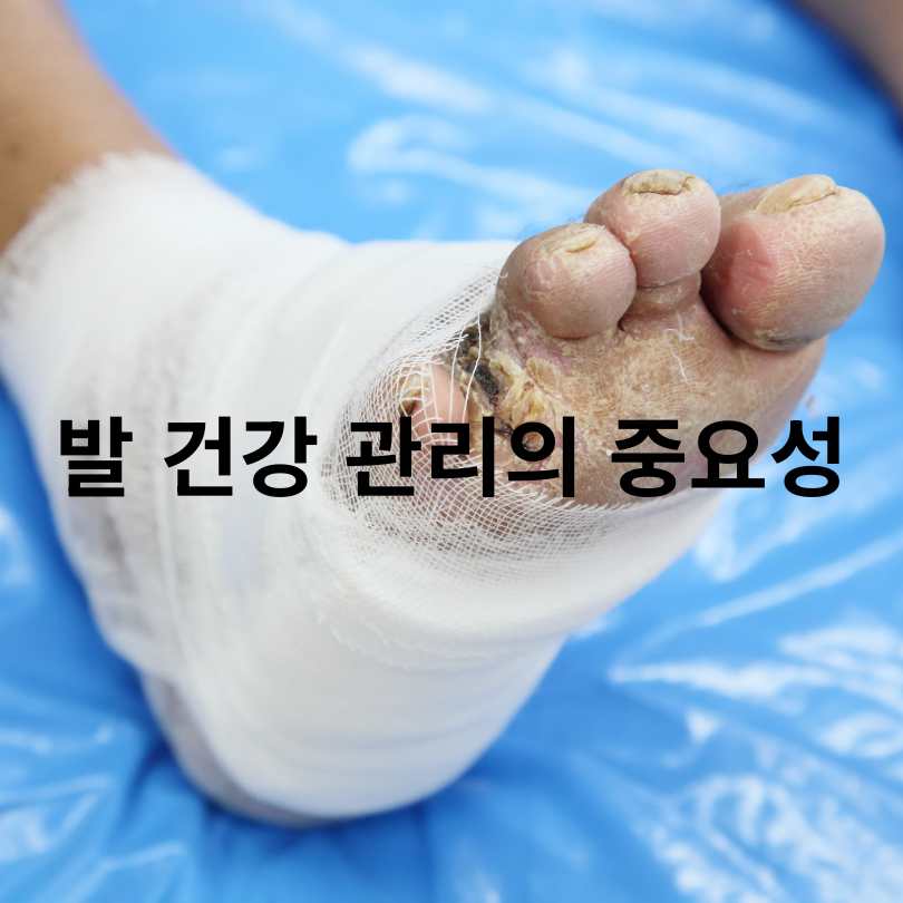 여름철 당뇨 관리 비법