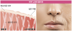 피부콜라겐