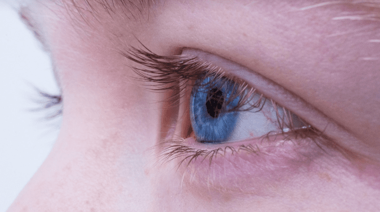 결막염 관련 안과 사진