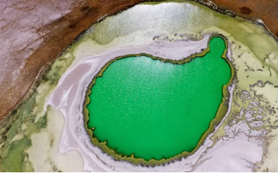 신장이 안좋으면 나타나는 증상