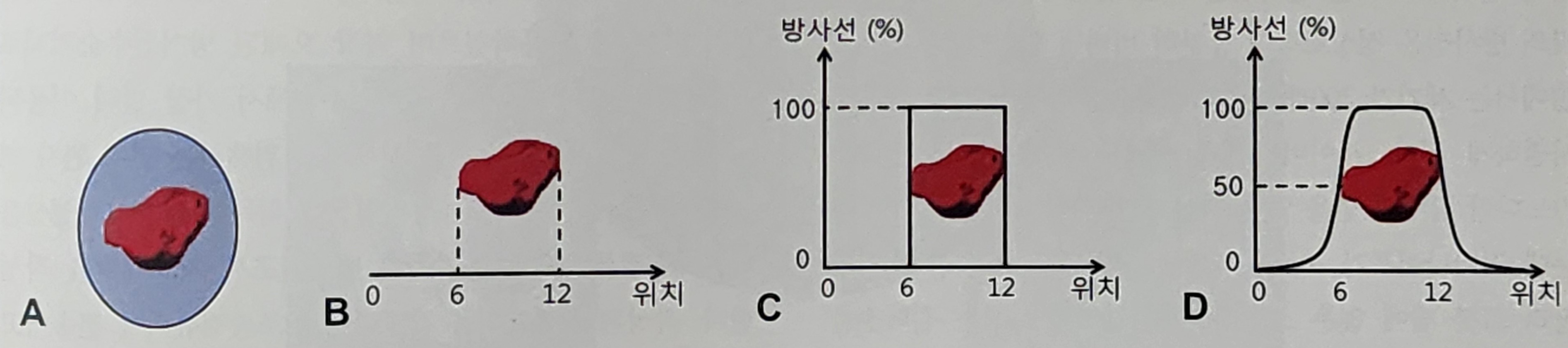 방사선수술기계와 그 원리