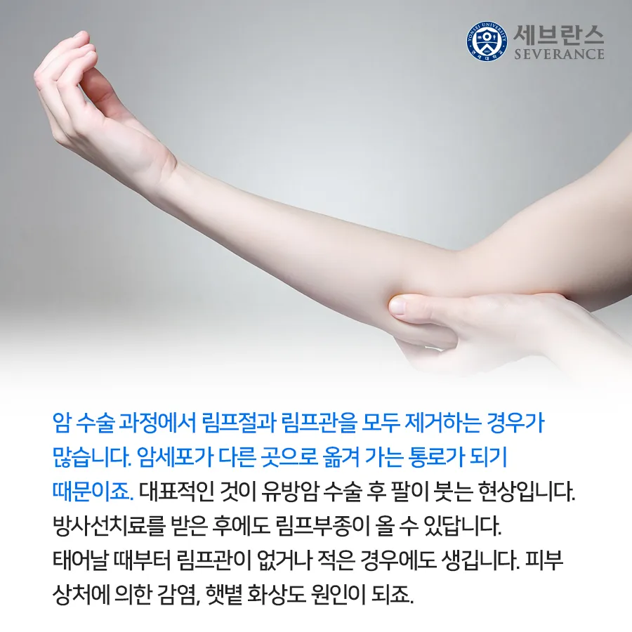 부종의 원인과 증상 5가지 개선방법 치료법_3