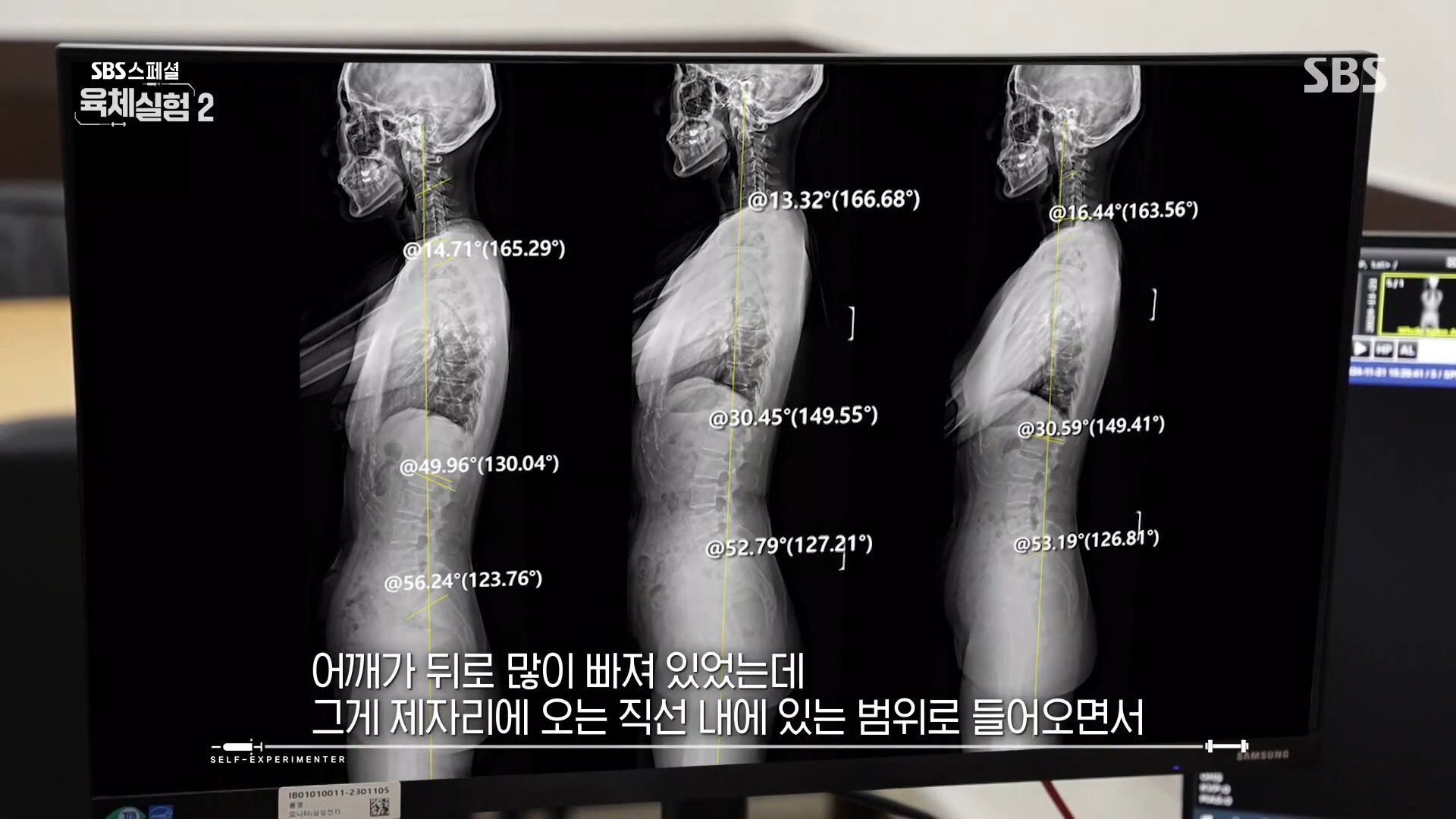 거북목 알림 진동 기계 힐디넥 에그 SBS 스페셜 육체실험 바른 자세