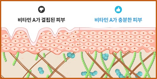 레티놀