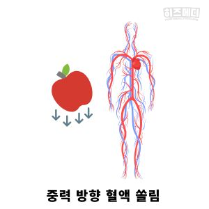 기립성 어지럼증