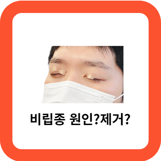 비립종