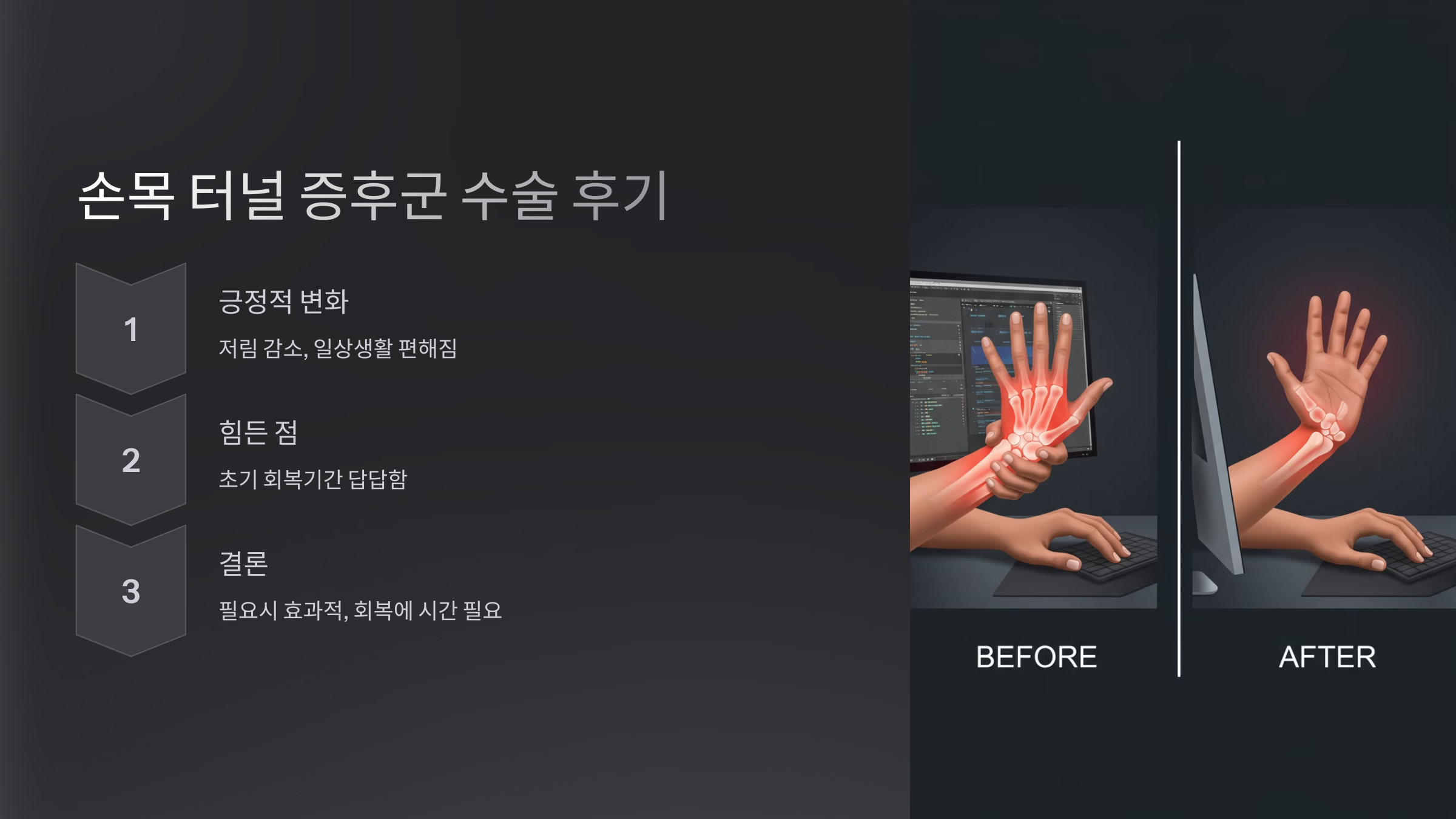 6. 손목 터널 증후군 수술 후기 – 경험담 정리