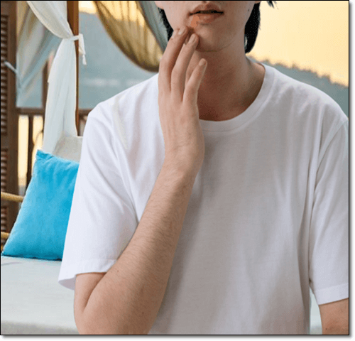 헤르페스 구순포진 환자