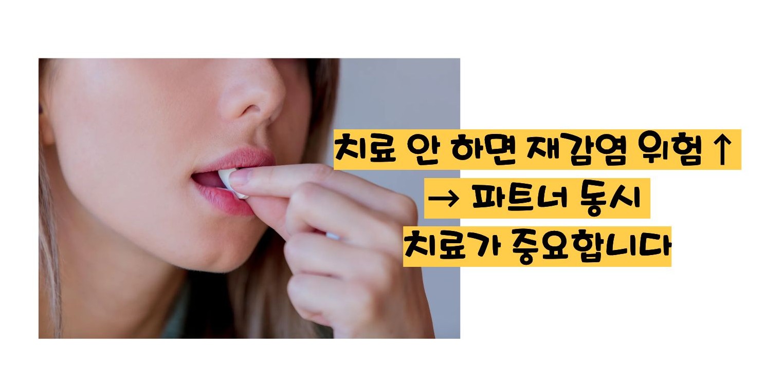 트리코모나스 질염 증상