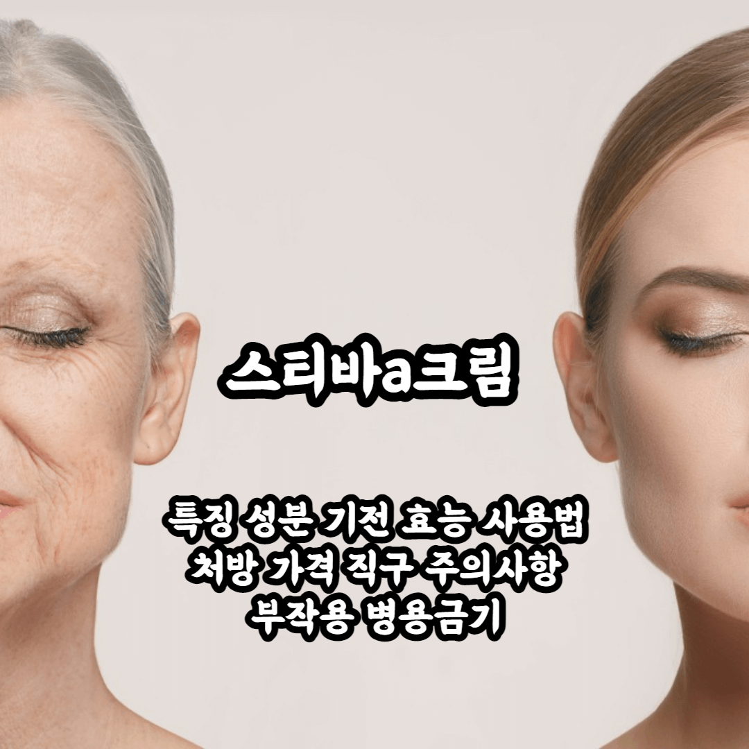 스티바a크림 블로그 썸네일 사진