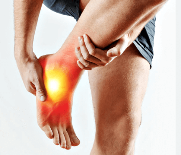 발목염좌수술 이후 1주차 재활운동하는 모습