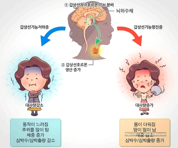 갑상선기능저하증, 몸의 에너지가 떨어질 때 생기는 신호