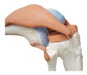 무릎 연골 염증