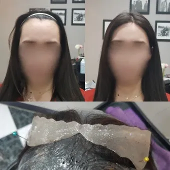 이마가 넓은 여자 관상 특징과 해석_19