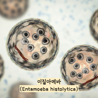 식중독-증상