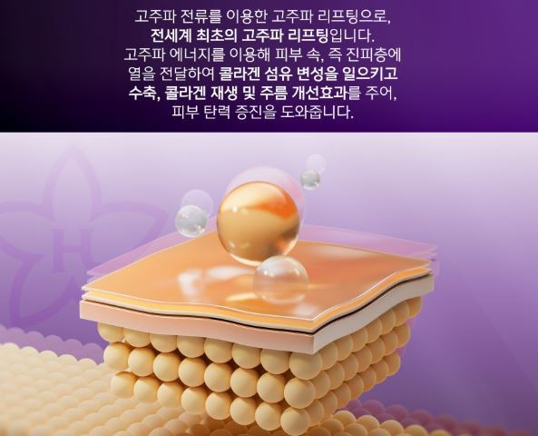 울쎄라효과