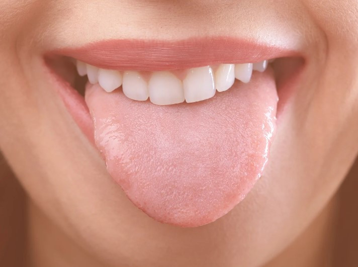 혓바늘 원인 6가지 및 혓바늘 없애는 방법과 치료제 추천