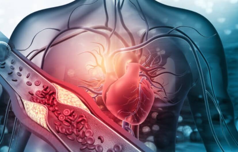 HDL콜레스테롤수치