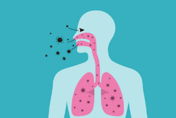 폐렴 증상, 전염성, 치료기간 총정리 (2025ver)