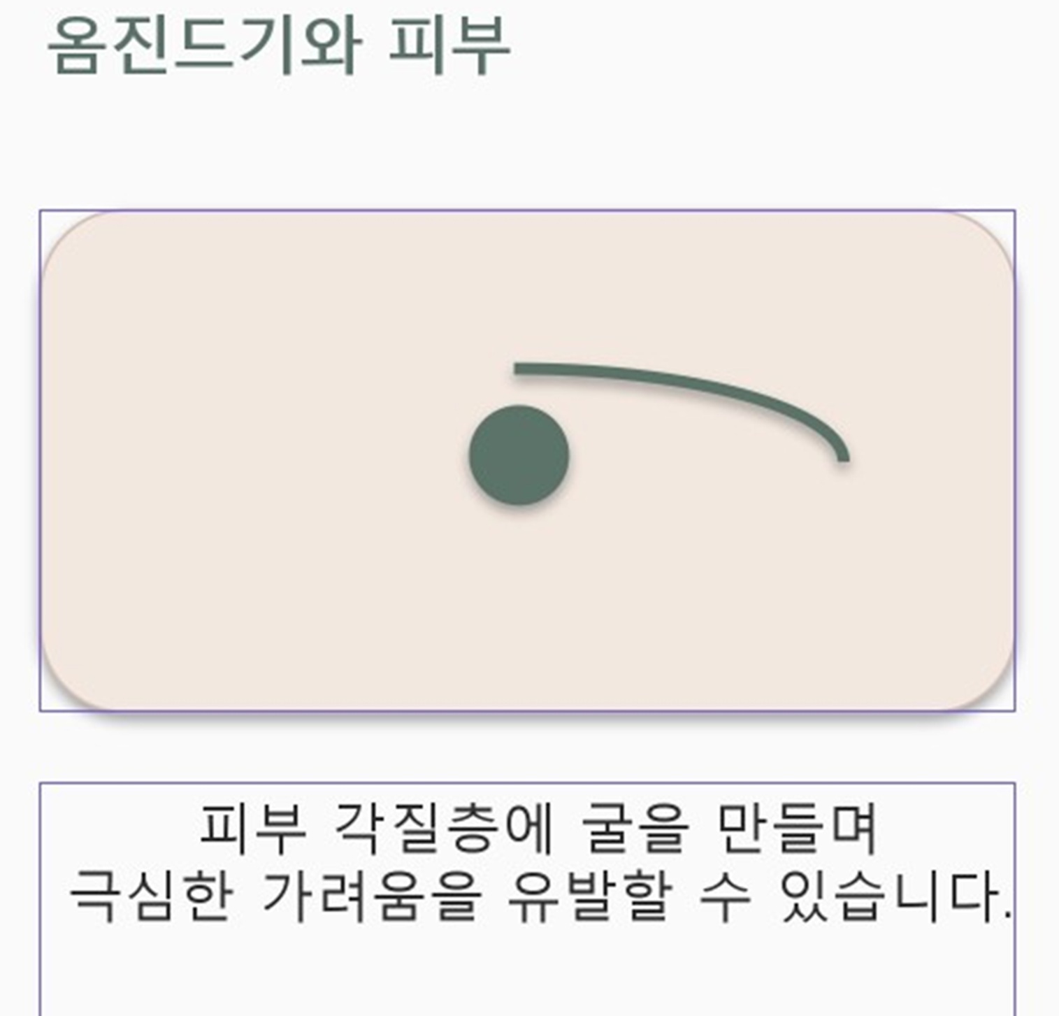 옴진드기