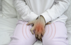 칸디다 질염 증상