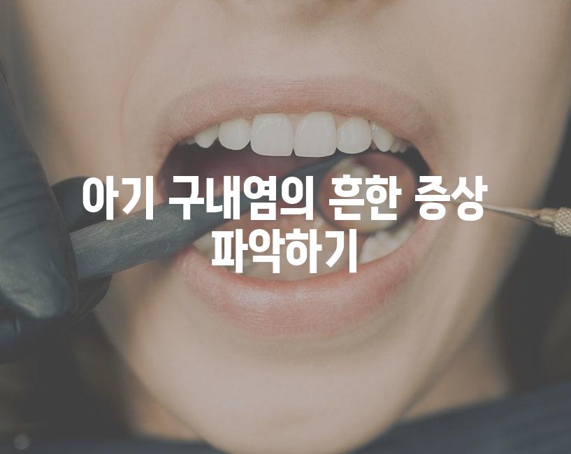 아기 구내염의 흔한 증상 파악하기
