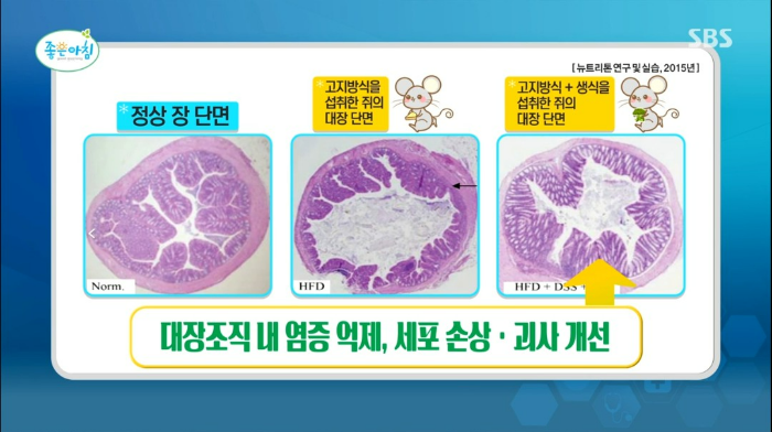 대장 건강 생식 식이섬유 효소 영양소