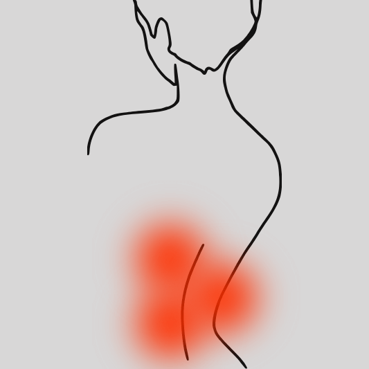허리-통증-이미지-예시
